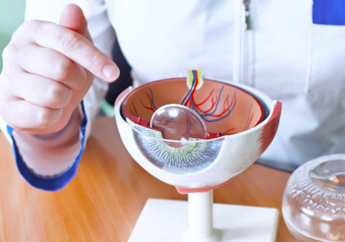 Can I Wear Contact Lenses After Cataract Surgery? - An Expert's Guide