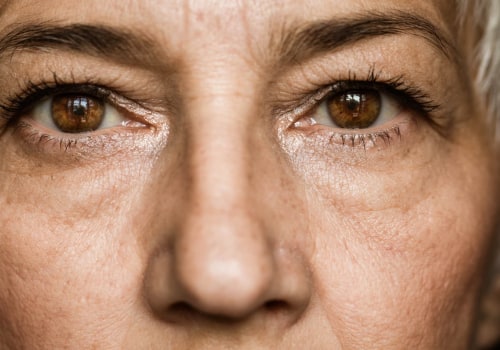 Cataract Surgery: How to Improve Your Vision Over Time