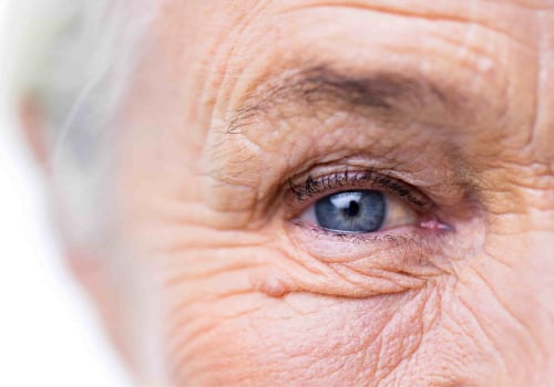 Recovering from Cataract Surgery: What to Expect